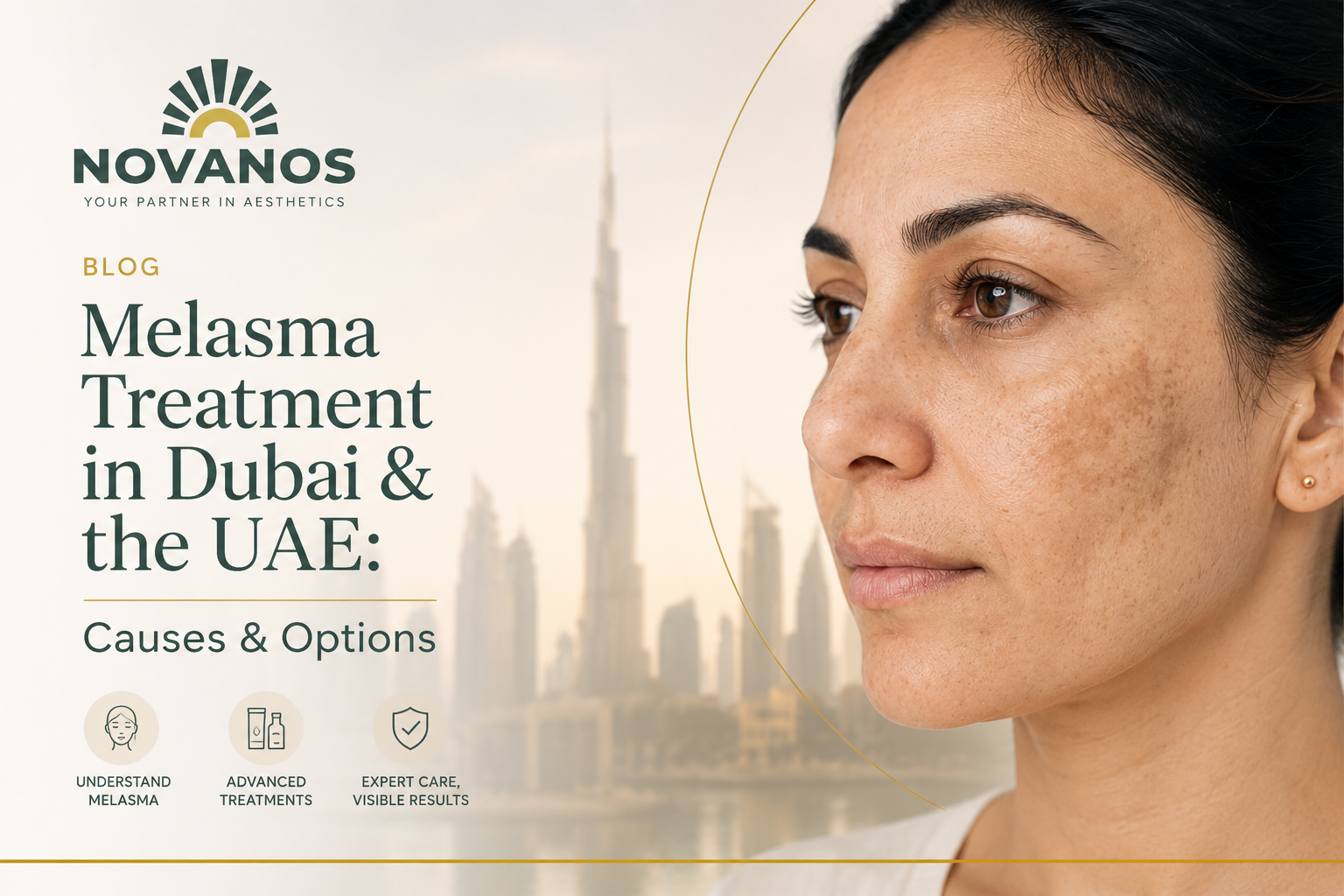 Melasma treatment in Dubai and the UAE